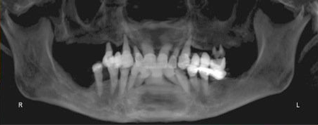 dental x-ray